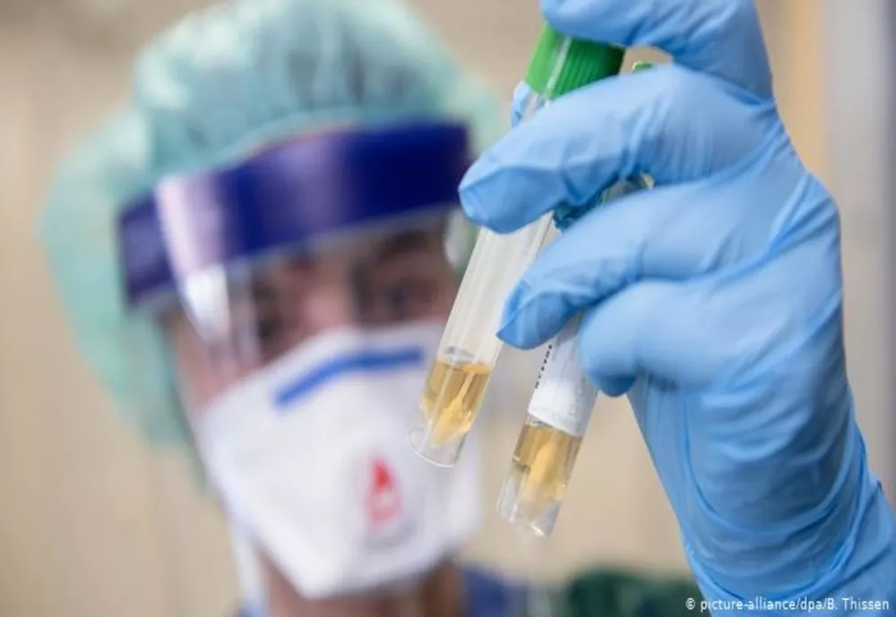 BILANȚ OFICIAL LA ZI: Coronavirus – 1952 de cazuri confirmate în România!