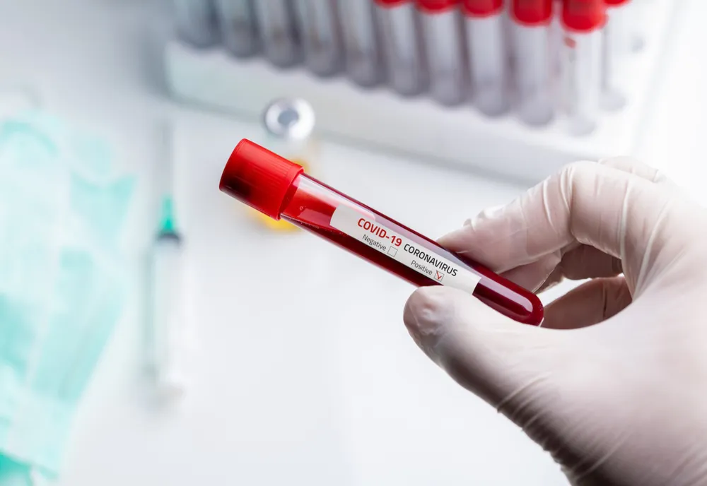 BILANȚ OFICIAL LA ZI: Coronavirus – 3613 de cazuri confirmate în România! Situația și pe județul Vaslui.