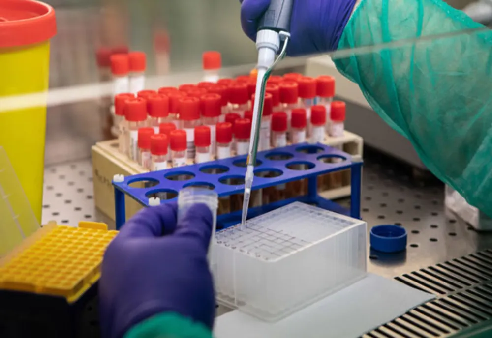 BILANȚ OFICIAL LA ZI: Coronavirus – 11.978 de cazuri confirmate în România! Situația și pe județul Vaslui.