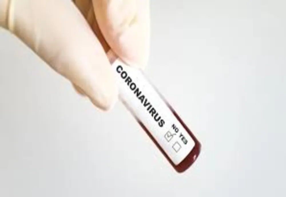Situația statistică actualizată, referitoare la COVID 19, pentru județul Vaslui, azi - 29 iulie 2020