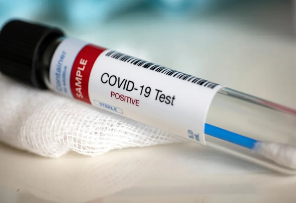 Situația statistică actualizată, referitoare la COVID 19, pentru județul Vaslui, azi - 17 octombrie 2020
