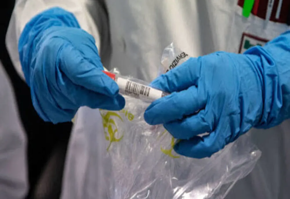 Bilanț coronavirus: 4.729 de cazuri noi și 121 de decese 