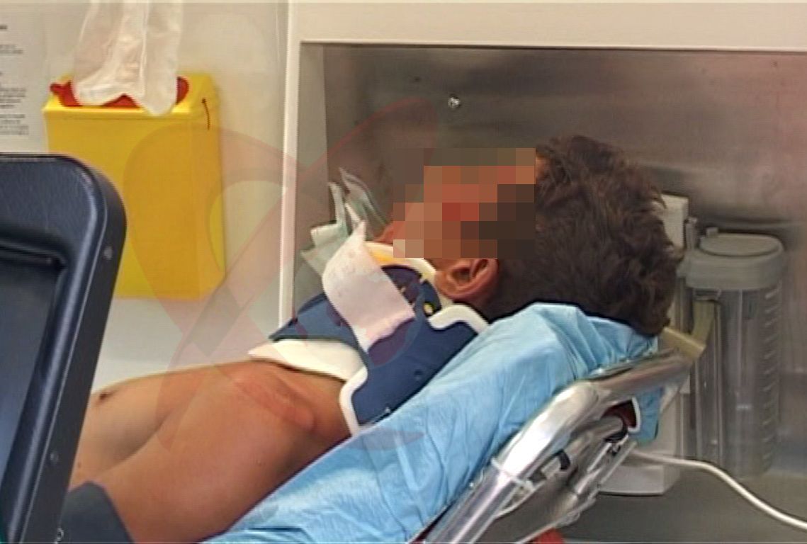 În stare gravă la spital, după ce a fost împuns de un taur, în cap!