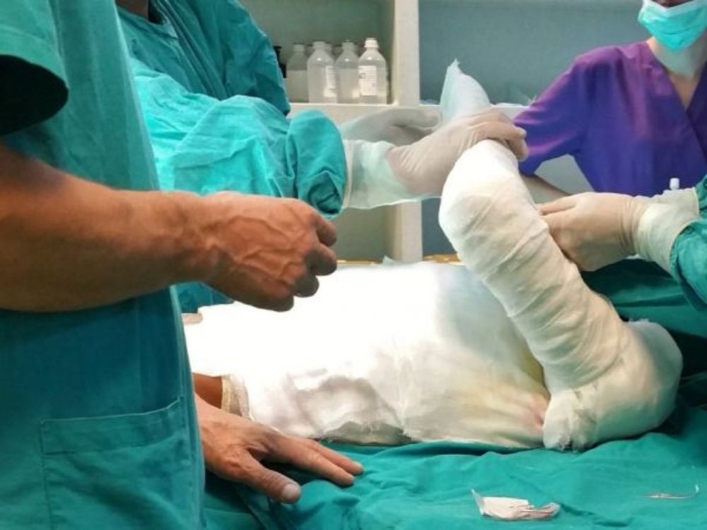 Incendiu în Bârlad! Un bărbat a suferit arsuri la mâini și față