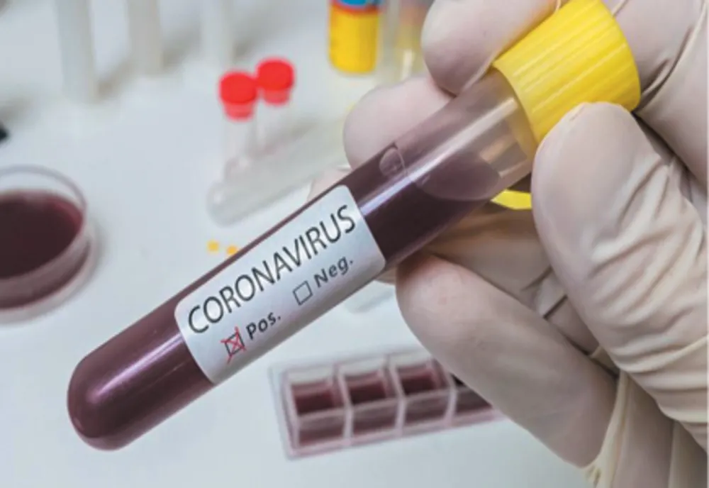 Situația statistică actualizată, referitoare la COVID 19, pentru județul Vaslui