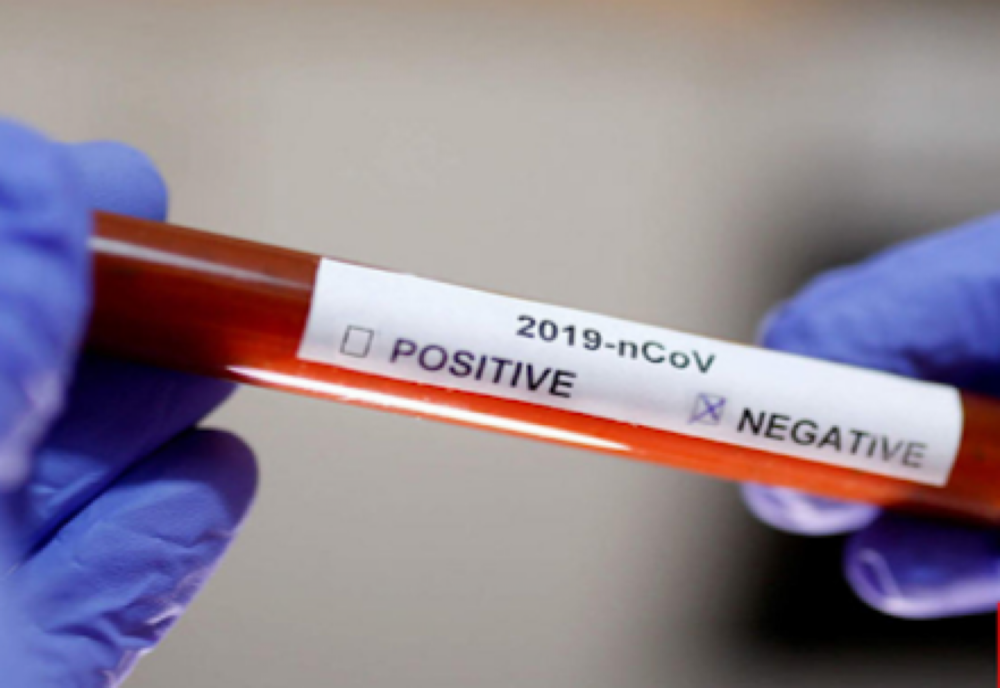 Situația statistică actualizată, referitoare la COVID 19, pentru județul Vaslui, azi - 18 iulie 2020