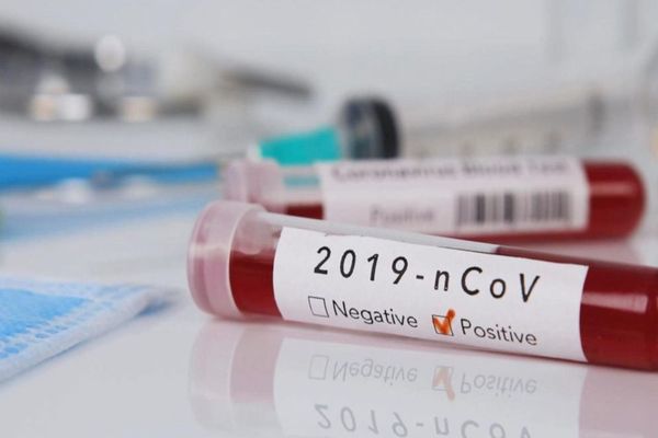 BILANȚ OFICIAL LA ZI: Coronavirus – România: 576 de cazuri confirmate