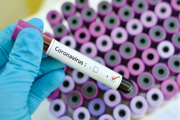 Bilanț coronavirus 10 septembrie: 1.380 de noi infectări și 47 de morți de decese