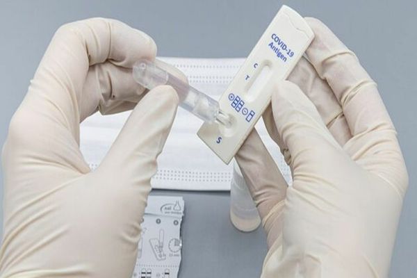 Românii se vor putea testa gratuit pentru COVID la medicii de familie