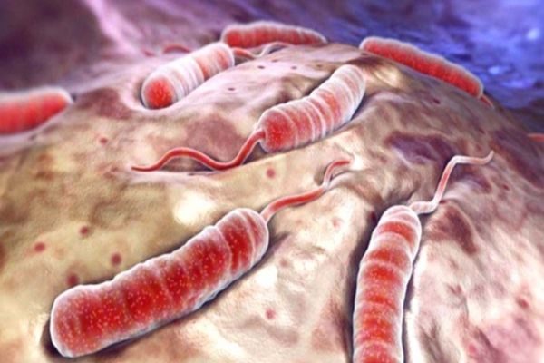 Alertă de HOLERĂ în Suceava! RECOMANDĂRI cruciale pentru populație - Ce trebuie EVITAT