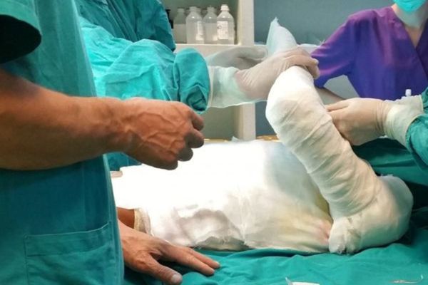 Incendiu în Bârlad! Un bărbat a suferit arsuri la mâini și față