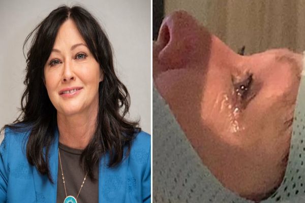 „Cancerul a ajuns la creier”. Cât mai are de trăit Shannen Doherty