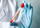 BILANȚ OFICIAL: Coronavirus - România: 168 de cazuri confirmate