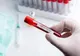 BILANȚ OFICIAL LA ZI: Coronavirus – 3613 de cazuri confirmate în România! Situația și pe județul Vaslui.