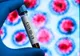 BILANȚUL la zi transmis de autorități: Coronavirus – 15.778 de cazuri confirmate în România! Situația și pe județul Vaslui.