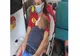Copilul mușcat de față de câinele familiei, este în stare bună la spitalul „Sf. Maria” din Iași