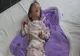 Cum arată acum fetița hrănită doar cu ceai și pufuleți, care în urmă cu 9 ani ajungea la spital în stare gravă