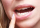 Aftele bucale. De ce apar și cum scăpăm de ele